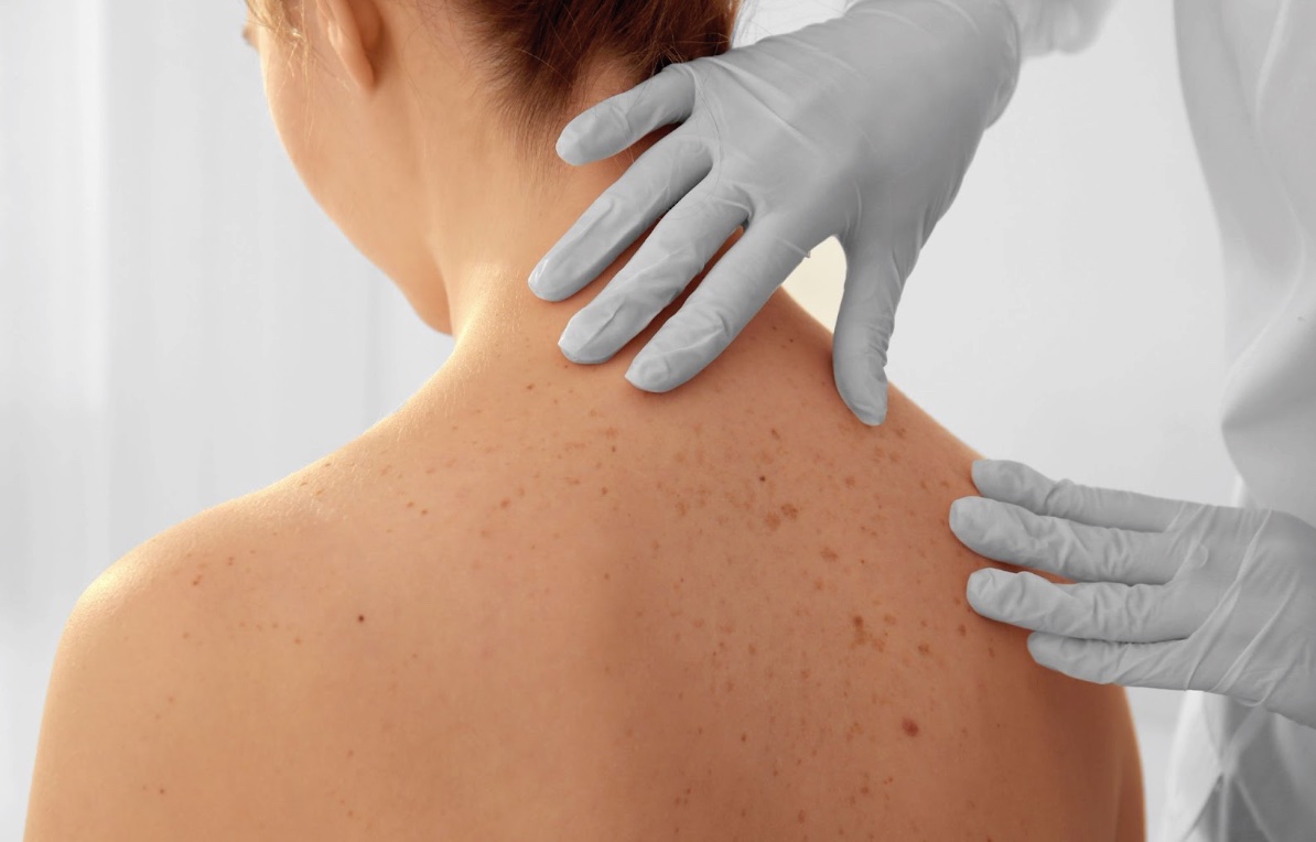 Как защититься от кожных заболеваний: советы дерматолога